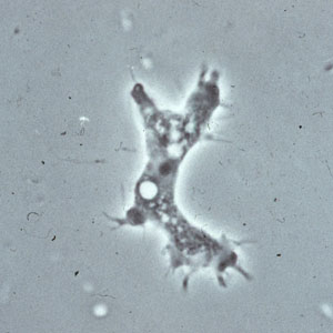 Trophozoite of Acanthamoeba sp. from culture. Notice the slender, spine-like acanthapodia. Adapted from CDC