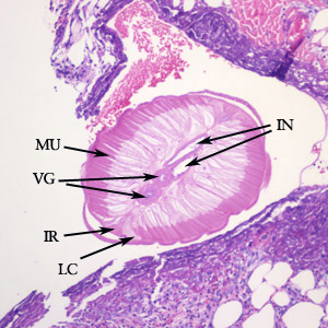 Cross-section of Dirofilaria sp. from a subcutaneous nodule, stained with hematoxylin and eosin (H&E). Morphologic features visible in this image include tall, prominent muscle cells (MU), coiled vagina (VG), coiled intestine (IN), lateral chords (LC), and prominent internal lateral ridges (IR). Image courtesy of Drs. Dirk Elston and Paul Bourbeau. Adapted from CDC