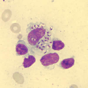 Leishmania sp. amastigotes in a Giemsa-stained tissue scraping. Adapted from CDC