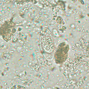 Immature oocyst of C. belli in an unstained wet mount, containing a single sporoblast. Adapted from CDC