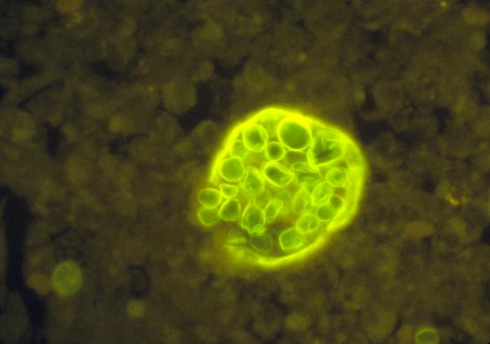 File:Cimmitis spherule endospores.jpg