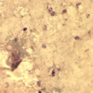 Encephalitozoon cuniculi spores stained with Gram Chromotrope. Adapted from CDC