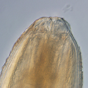 Anterior ends of Pseudoterranova sp. worms; images taken at 40x and 200x magnification, respectively. Adapted from CDC