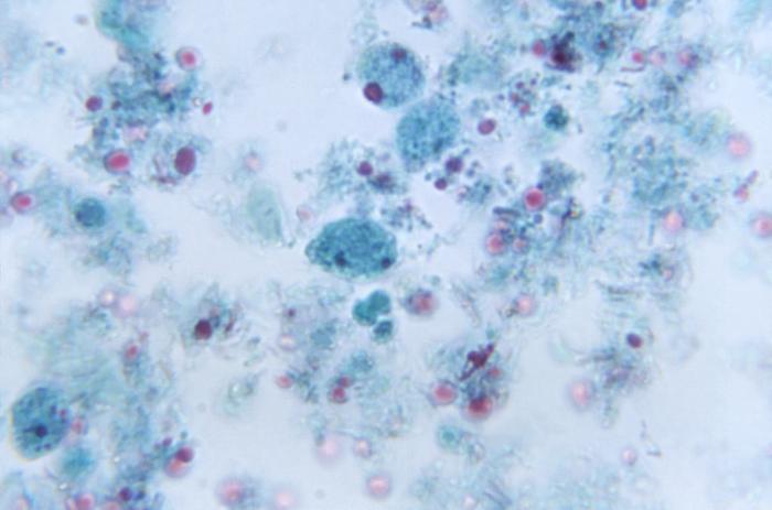 Trichrome-stained photomicrograph reveals the presence of a parasitic Dientamoeba fragilis trophozoite (1150x mag). From Public Health Image Library (PHIL). [1]