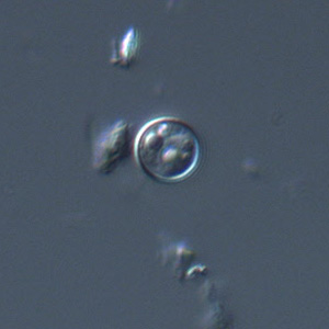 Oocyst of C. cayetanensis viewed under differential interference contrast (DIC) microscopy. The refractile globules are easily visible under DIC. Adapted from CDC