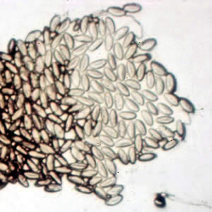 Eggs of E. vermicularis in a cellulose-tape preparation. Adapted from CDC
