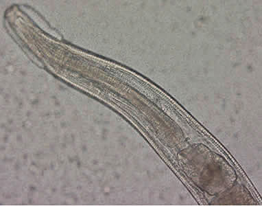 File:Evermicularis adult anterior Norway.jpg