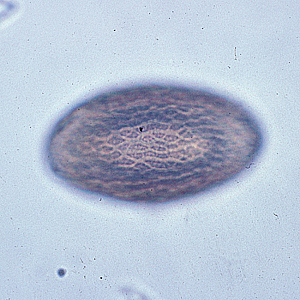 Image of the same egg in Figure 2, but in a different plane of focus, showing the textured exterior. Adapted from CDC