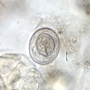 Egg of H. nana in an unstained wet mount. Note the presence of hooks in the oncosphere and polar filaments within the space between the oncosphere and outer shell. Adapted from CDC
