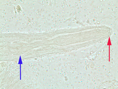Close-up of the anterior end of a rhabditiform larva of S. stercoralis, showing the short buccal canal (red arrow) and the rhabditoid esophagus (blue arrow). Image taken at 1000x oil magnification. Adapted from CDC