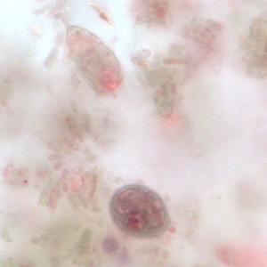 Cyst (lower) and trophozoite (upper) of C. mesnili in a stool specimen, stained with trichrome. Image taken at 1000x magnification. Adapted from CDC