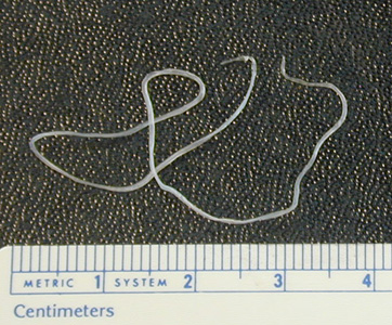 Dirofilaria sp. (suspect D. tennis) removed from the eye of a patient. Adapted from CDC