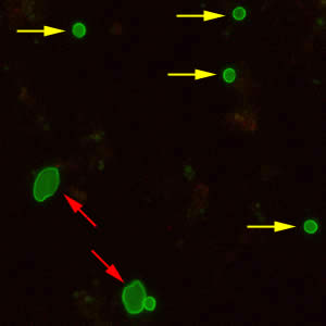 Cryptosporidium sp. oocysts (yellow arrows) and cysts of Giardia duodenalis (red arrows) labeled with immunofluorescent antibodies. Adapted from CDC