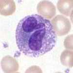 Eosinophil granulocyte