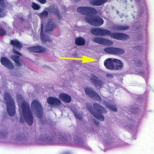 Oocyst of C. belli in the epithelial cells of a mammalian host, stained with H&E (yellow arrow). Adapted from CDC