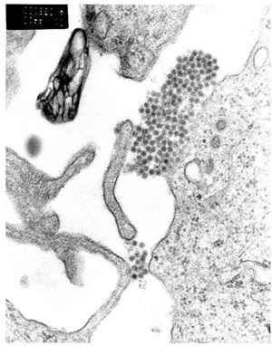 A TEM micrograph showing dengue virus virions (the cluster of dark dots near the center).