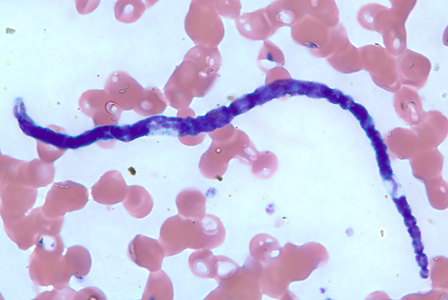 Microfilaria of M. perstans in a thin blood smear from the same specimen as Figures 1-3. Adapted from CDC