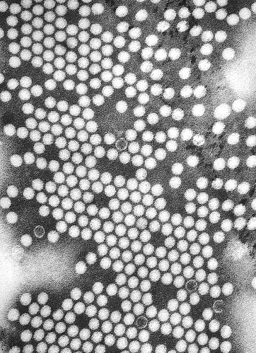Electron micrograph of the poliovirus, a species of Enterovirus. From Public Health Image Library (PHIL). [27]
