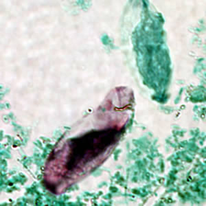 Immature oocyst of C. belli stained with acid-fast, showing a single sporoblast. Adapted from CDC