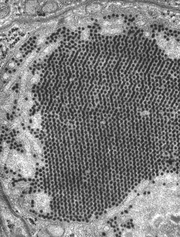 Transmission electron micrograph (TEM) reveals the presence of numerous St. Louis encephalitis virions that were contained within a mosquito salivary gland tissue sample. From Public Health Image Library (PHIL). [4]