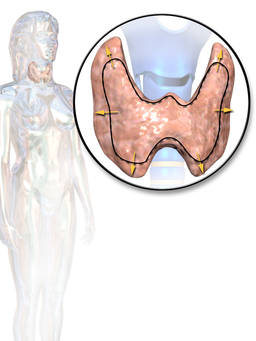 File:Goiter graphic.png