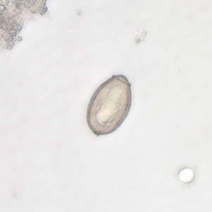 C. sinensis egg; images taken at 400× magnification. Adapted from CDC