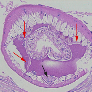 Higher-magnification of the specimens shown in Figures 1-4. Shown in this image are the tall, polymyarian muscle cells, the characteristic ventral chord with a U-shaped row of nuclei (black arrow), and three pseudocoelomic membranes (red arrows). Adapted from CDC