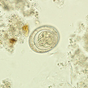 Egg of H. nana in an unstained wet mount. Adapted from CDC