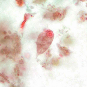 Trophozoite of C. mesnili from a stool specimen, stained with trichrome. Image taken at 1000x magnification. Adapted from CDC