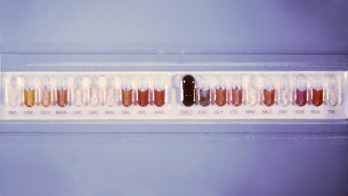 This strip of API® wells was inoculated with Clostridium perfringens. From Public Health Image Library (PHIL). [1]