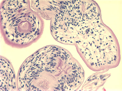 File:Egranulosis protoscoleces PHXChild A.jpg