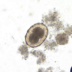 Fertilized egg of A. lumbricoides in unstained wet mounts of stool, with embryos in the early stage of development. Adapted from CDC