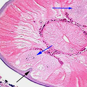 Higher magnification of the same specimen as Figure 3, taken at 400x magnification. Note the presence of lateral chords (blue arrows) and internal lateral ridge (black arrow). Adapted from CDC