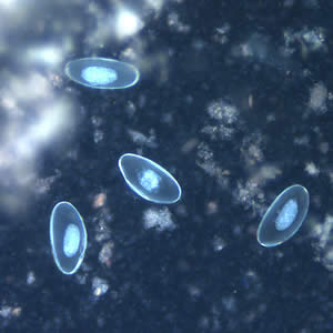 Eggs of E. vermicularis viewed under UV microscopy. Adapted from CDC