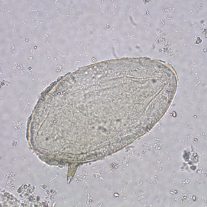 Egg of S. mansoni in an unstained wet mount. Images courtesy of the Missouri State Public Health Laboratory. Adapted from CDC