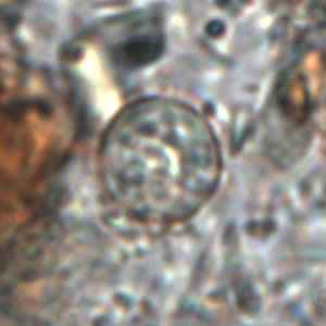 Oocyst of C. cayetanensis in an unstained wet mount. Image courtesy of the Oregon State Public Health Laboratory. Adapted from CDC