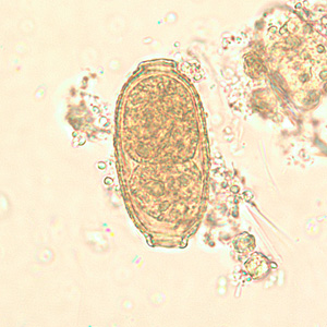 Egg of C. philippinensis in an unstained wet mount of stool. Adapted from CDC