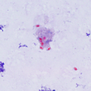 Spores of E. cuniculi from urine stained with Ryan's modified trichrome (Trichrome blue). Adapted from CDC