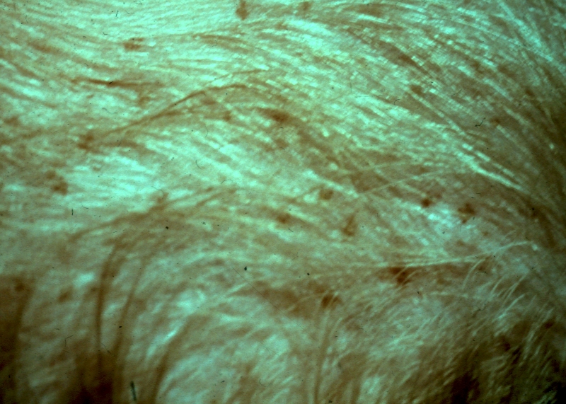 Fig.1 Pubic lice in genital area