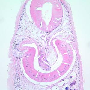 Close up of the anterior end of the worm is Figure 1. Adapted from CDC