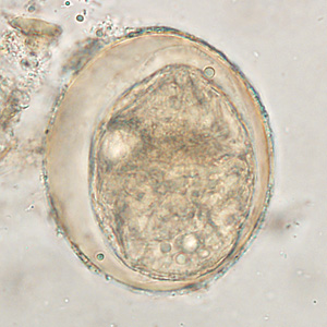 Egg of S. japonicum in an unstained wet mount of stool. The spine is not visible in either of these specimens. Adapted from CDC