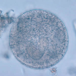 B. coli cysts in a wet mount, unstained. Adapted from CDC