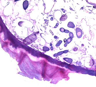 Cross-sections of T. penetrans in tissue, stained with hematoxylin and eosin (H&E). Adapted from CDC