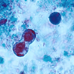 B. hominis cyst-like forms undergoing binary fission; stained with trichrome. Adapted from CDC