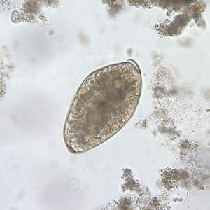 Egg of F. buski in an unstained wet mount of stool. Adapted from CDC