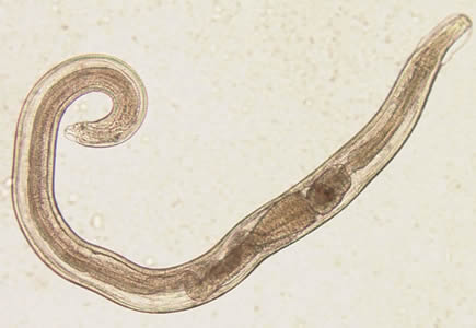 Adult male of E. vermicularis from a formalin-ethyl acetate (FEA) concentrated stool smear. The worm measured 1.4 mm in length. Image contributed by the Centre for Tropical Medicine and Imported Infectious Diseases, Bergen, Norway. Adapted from CDC