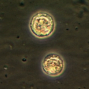 Cysts of B. mandrillaris. Adapted from CDC