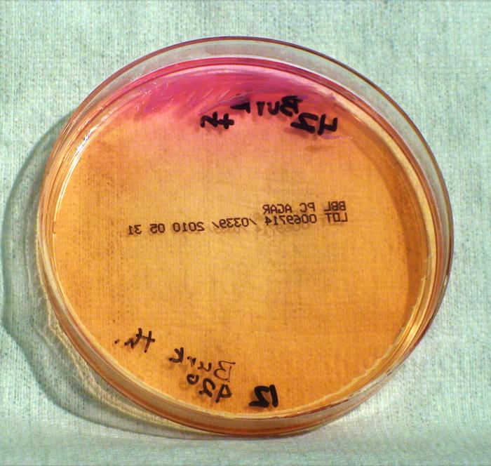Gram-negative Burkholderia thailandensis bacteria, which was grown on a medium of Pseudomonas cepacia (PC) agar 48hrs. From Public Health Image Library (PHIL). [5]