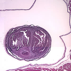 Larval Taenia solium cyst in a section of a lesion found in the right frontal lobe of a patient stained with hematoxylin and eosin (H&E), magnification 40×. Adapted from CDC