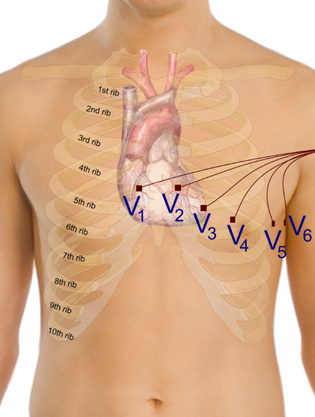 EKG interpretation basics - wikidoc